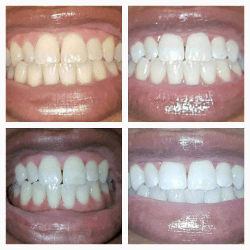 Pek Teeth Whitening Gold Serum Pen